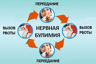 Лечение булимии в Сосногорске